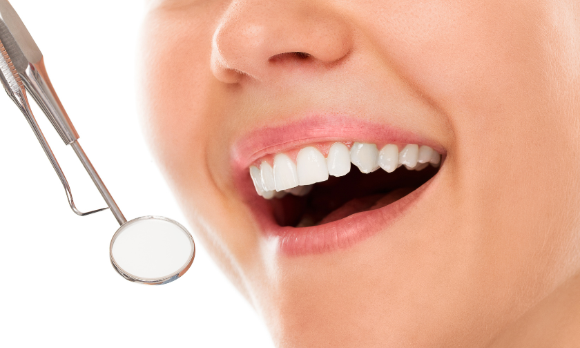 Teeth Whitening