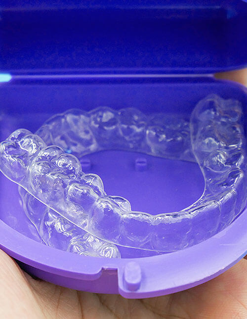 Invisalign-Teen