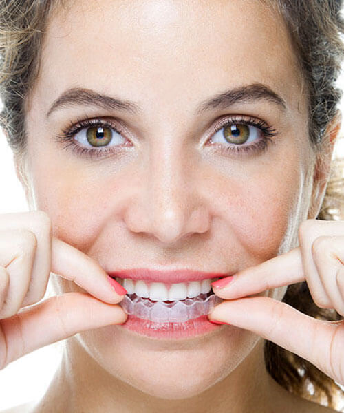 Invisalign
