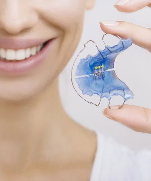 Vivera-Retainers