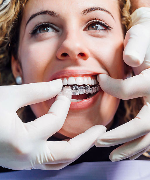 Invisalign for Teens and Adults