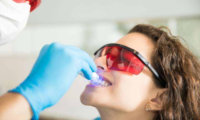 Teeth Whitening Fleming Island